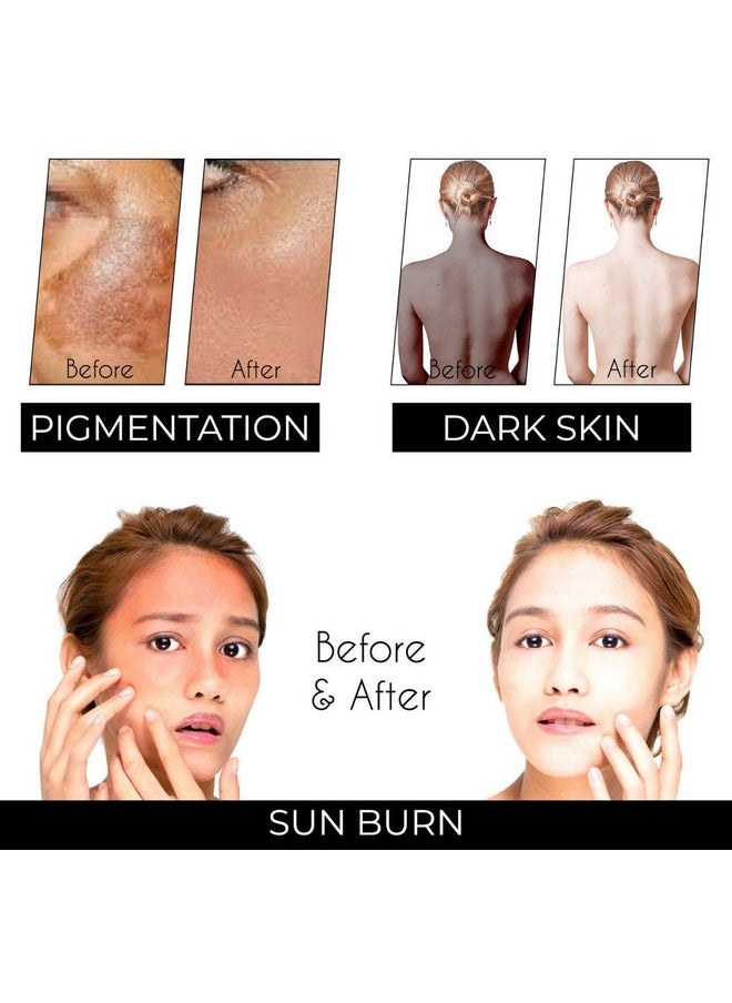 SKY BEAUTY ORGANIC - Vitae Glow Skin Lightening Oil With Kesar Chandan For Lightening Dark Spots Acne Marks Pigmentation All Skin Types 50Ml - Image 1