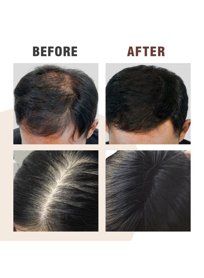 NUSPA NUSPA Herbal Hair Growth Shampoo Anti Hair Loss Hair Wash Infused With GingerGensengPolygonum Multiflorum Anti-Thinning Hair Thickening Products For Women & Men Daily Use  - Image 4