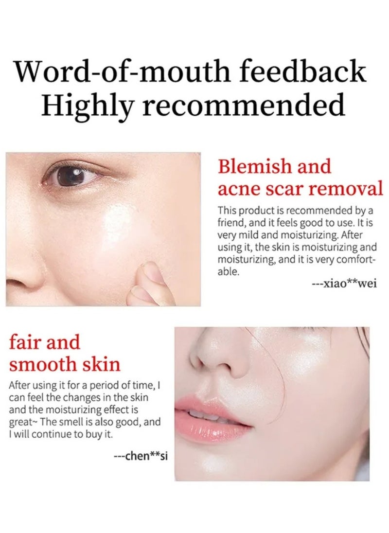 YOUBUY - Whitening Blemish Cream Whitening and Freckle Removing Cream Dark Spot Remover for Face Fade Fine Lines and Melasma Freckle Remover Hyperpigmentation Care Dark Circle Removing Essence 20g - Image 1