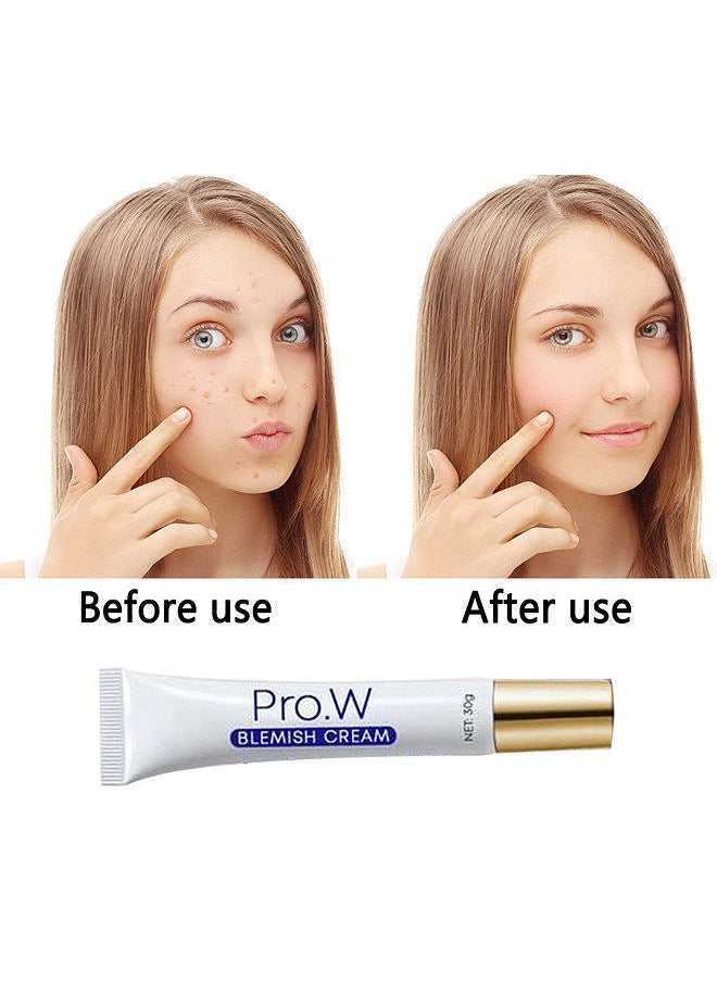 Generic - Pro. W Blemish Cream 30g Facial Cream Oil Control for Spots Freckles Acne Pimple Scar Dark Spots - Image 1