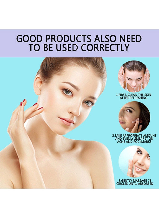 Generic - Pro. W Blemish Cream 30g Facial Cream Oil Control for Spots Freckles Acne Pimple Scar Dark Spots - Image 1