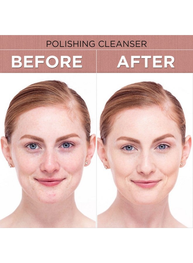 Shira Boto-Derm Rx Polishing Cleanser With Anti Anging Formulamakes Skin Wrinkle Free And Keeps Skin Hydrated And Nourisheduseful For Normal To Dry Skin (150Ml) - Image 4