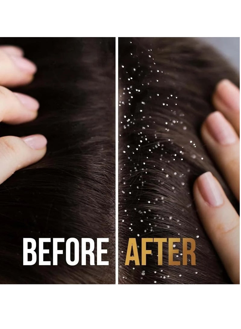 Pantene Anti Dandruff shampoo 600 ml - Image 2