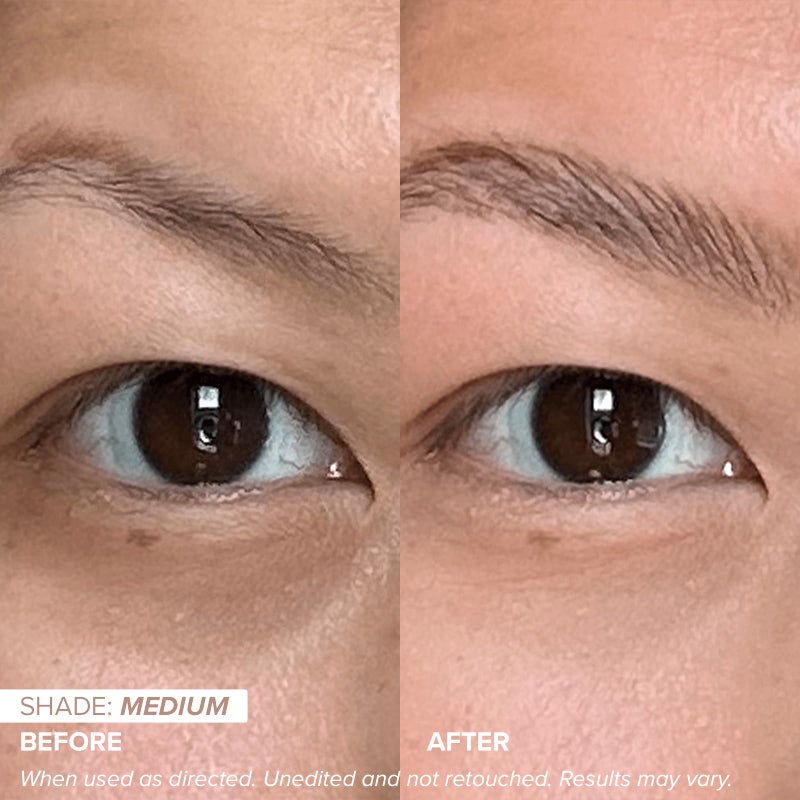 DRMTLGY تصحيح العين المتلألئة من DRMTLGY SPF 41، مصحح لون تحت العين للهالات السوداء، كريم عين ملون مضاد للشيخوخة، سيروم مرطب للعين مع نغمة خوخية مؤهل لـ FSA/HSA، متوسط - Image 2