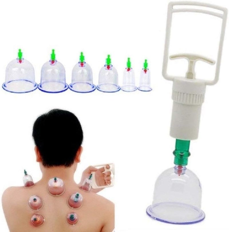 Derovan One-Time Acupuncture Cupping Set – Disposable Vacuum Suction Cups for Traditional Therapy, Muscle Relief & Supportive Weight Management - Image 4