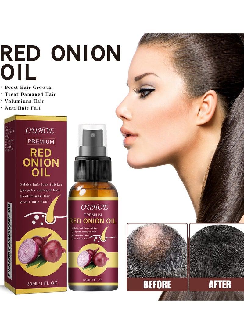 OUHOE 2 Bottles Red Onion Oil for Hair Oil with Onion Extract Onion Hair Growth Products for Men and Women Rapid Growth Anti-Hair Loss - Image 1