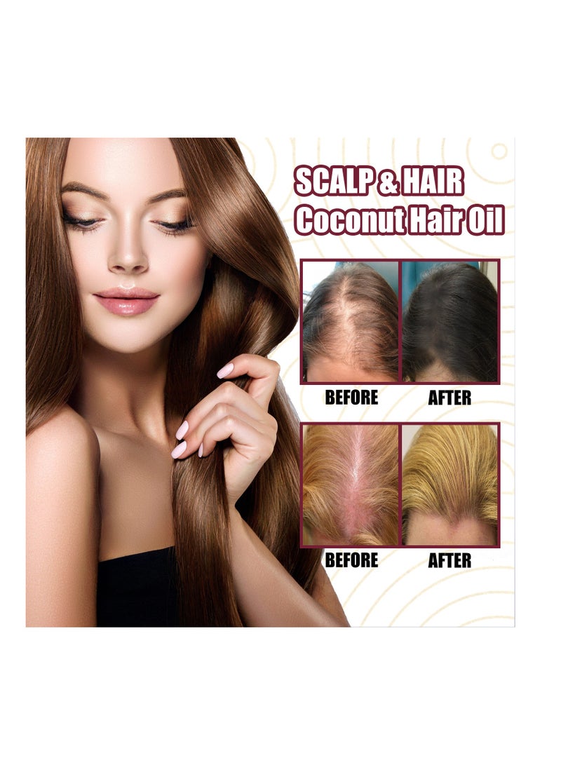 OUHOE 2 Bottles Red Onion Oil for Hair Oil with Onion Extract Onion Hair Growth Products for Men and Women Rapid Growth Anti-Hair Loss - Image 2