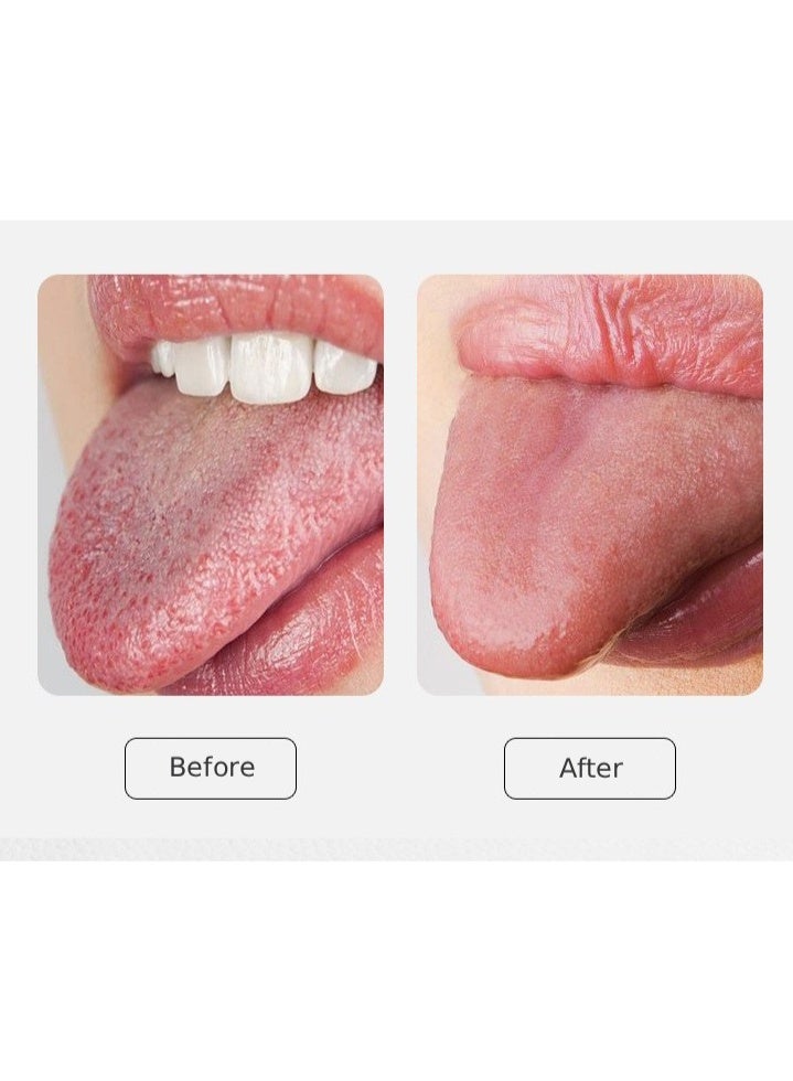 2PCS,Stainless Steel Tongue Cleaner - Tongue Scraper/Brush, Bad Breath Removal Tool - Image 5