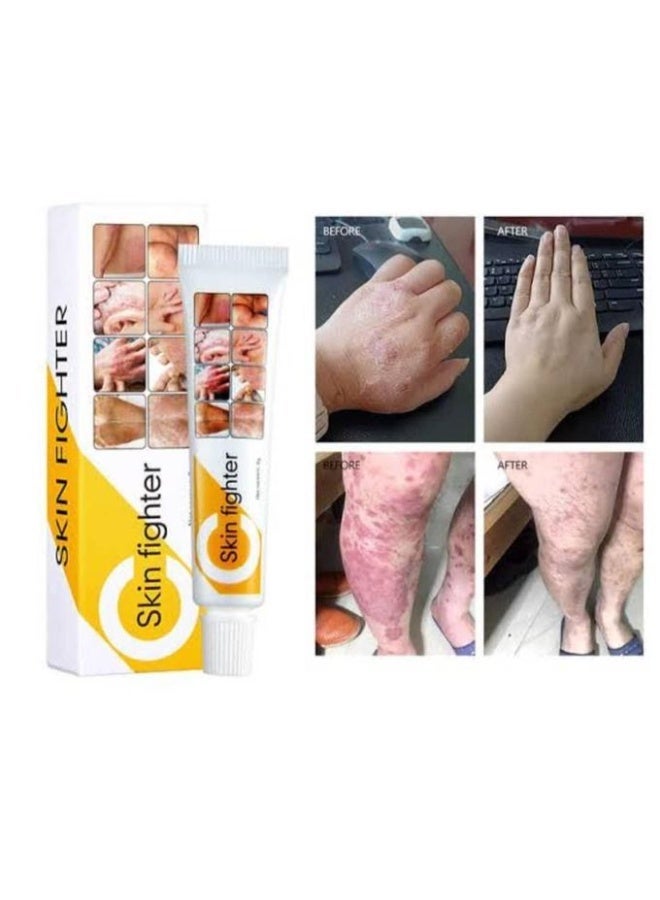 سكي كريم MD سكين فايتر 15 غرام – علاج موضعي متعدد الاستخدامات لتهيج البشرة، حب الشباب، ومشاكل الفطريات والبكتيريا - Image 2