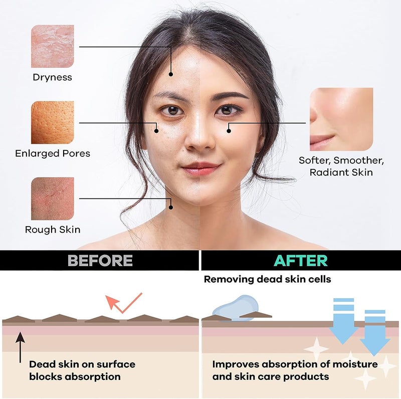 Dermasuri Deep Exfoliating Face Mitt - Scrubber, Dead and Dry Skin Remover for Men and Women - Exfoliator Gloves for Shower and Dry Use - ( 1 Pack) - Image 5