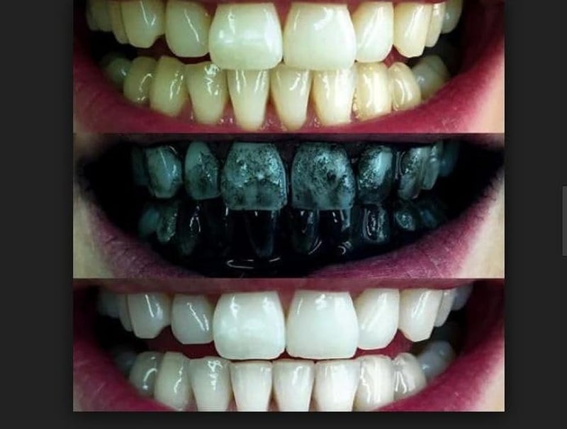 Whitening Toothpaste Herbal Activated Charcoal - 140ml - Image 2