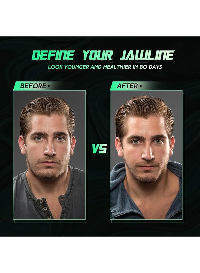 Photon 3 قطع لتمرين الفك للرجال والنساء، مزيل للذقن المزدوجة، أقراص سيليكون لتمرين خط الفك - Image 5