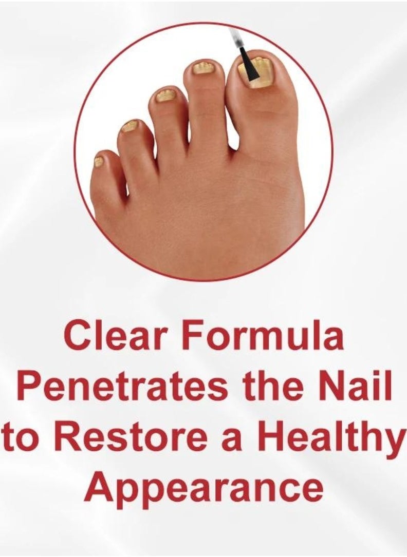 DERMFREE - Multi Purpose Nail Repair Fungus Treatment Toenail Fingernail Fungal Renewal Treatment Toenail Fungus Treatment Solution Nail Psoriasis Aging Nails Fungus Damaged Repair Gel 30ML - Image 1
