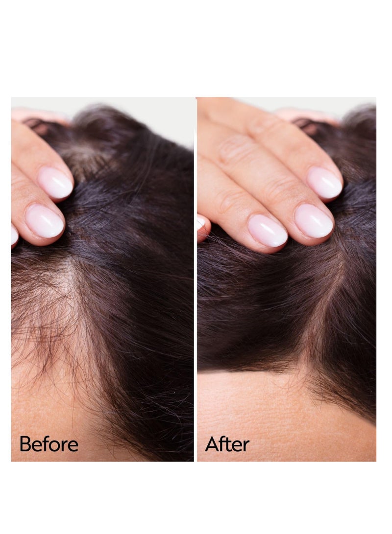 أهوهو سيروم أهوهو العضوي لتقوية الشعر ومكافحة التساقط يحتوي على  ريدينسيل لنمو الشعر وتقوية الجذور 100 مل - Image 3