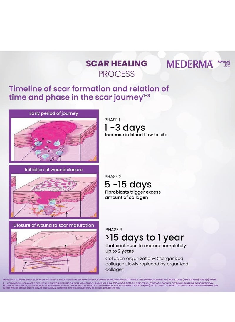 Mederma Advanced Plus Scar Gel, Purple, 10 g - pzsku/Z06F99B3BDACCB9A7E5E3Z/45/_/1727024437/93e77f2b-de24-41b1-bee3-fa2506db0c77