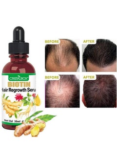 Cristalbox 5 Pack Ginger Oil For Hair Growthhair Growth Serumbiotin Hair Growth Oilhair Growth Ginger Serum For Men And Womenhair Growth Treatmenthair Loss Treatmentpromotes Thickergrowth Hair  - Image 4