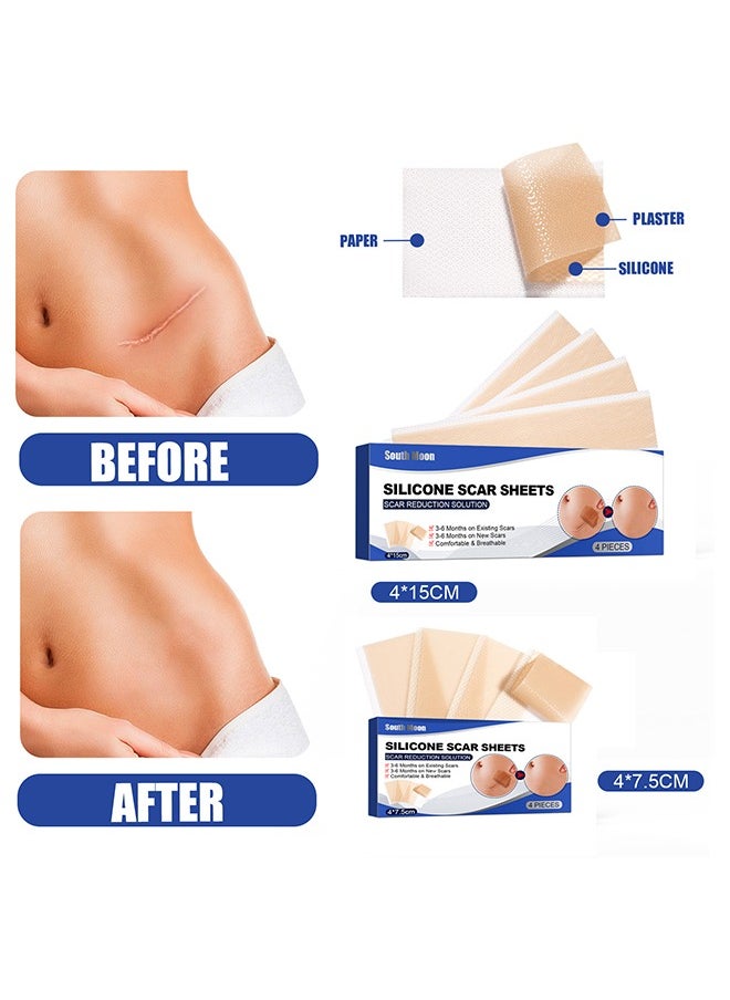 SOUTH MOON - 4Pieces Professional Silicone Scar Sheets, Scar Removal Patch, Soften and Flattens Scars Resulting from Surgery, Injury, Burns, Hypertrophic, C-Section and More, Soft Silicone Scar Strips 4x15cm - Image 1
