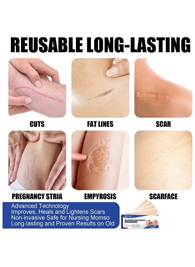 SOUTH MOON - 4Pieces Professional Silicone Scar Sheets, Scar Removal Patch, Soften and Flattens Scars Resulting from Surgery, Injury, Burns, Hypertrophic, C-Section and More, Soft Silicone Scar Strips 4x15cm - Image 1