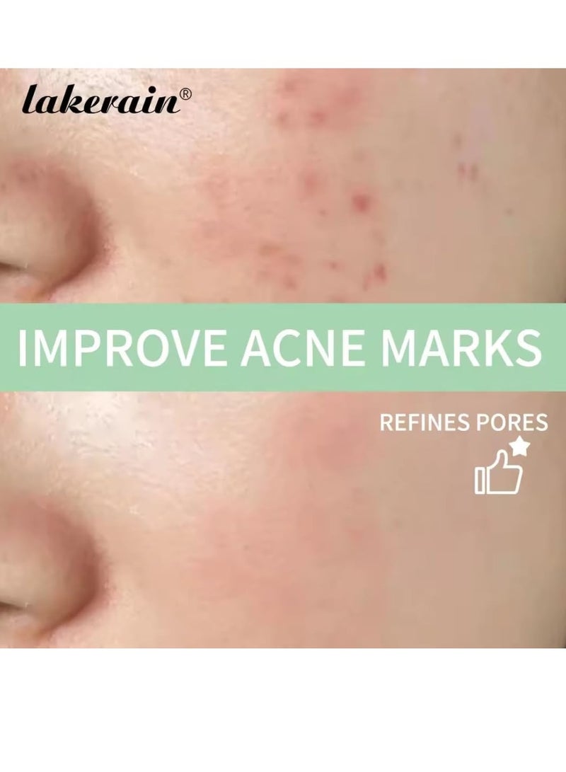 lakerain 100ml 7% Glycolic Acid Toner Contains AHAs Glycolic Acid Toning Solution Exfoliating Serum for Face Hydrates and Reduces Skin Blemishes Shrink Pores Anti Aging Facial Toner - Image 5