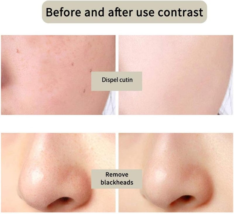 woobles Pore Compaction Volcanic Mud Mask Moisturize Fine Lines And Repairing Clean And Refreshing Facial-mask (Grey) - Image 4