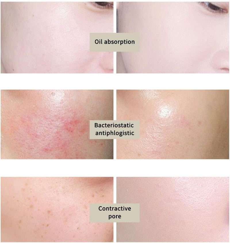 woobles Pore Compaction Volcanic Mud Mask Moisturize Fine Lines And Repairing Clean And Refreshing Facial-mask (Grey) - Image 3