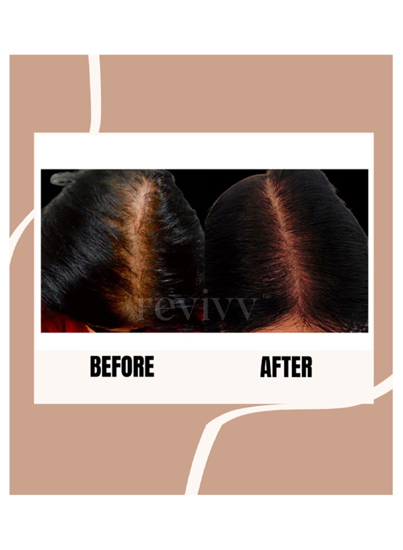 REVIVV Hair topical serum for her - Image 5