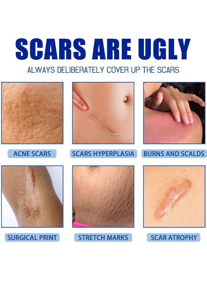 Jaysuing Scar Removal Cream, Hight Quality Scar Removal Cream, Acne Scar Treatment, Deep Acne Scar Removal, Burns Keloids Hypertrophic, Repair Damaged Skin, Stretch Marks And Scar Cream For Surgical Scars, Removing Acne Marks Scar Repair Cream, 30G - Image 4