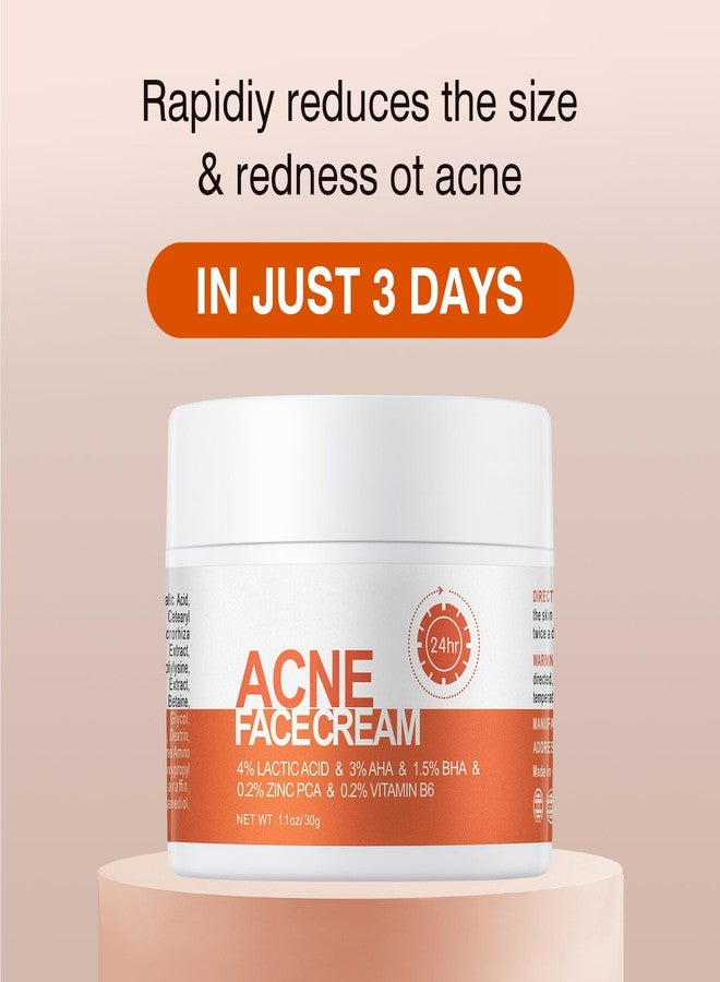 YAFUSIPE Acne Treatment for Face Hormonal Cystic Stubborn Acne Cream Back Butt Acne Spot Treatment for Teens Adults Moisturizer Pimple Rapid Clearing Cream for Breakouts Blemish Overnight 30g - Image 3