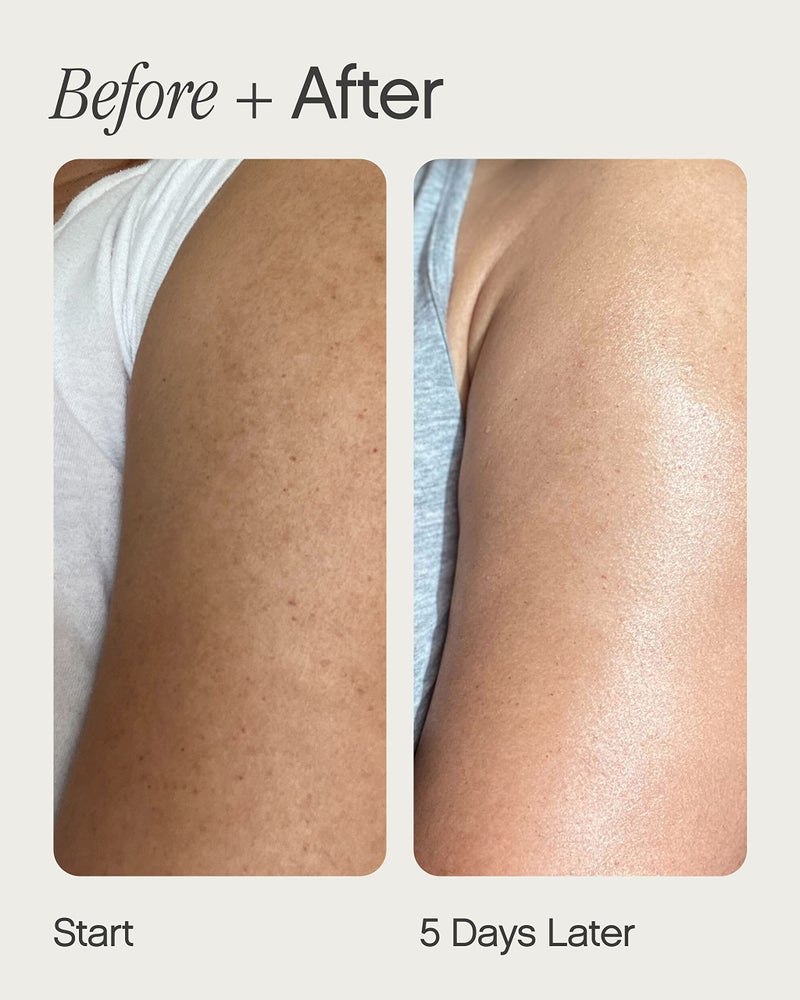 TOPICALS سيروم تقشير الجسم من توبكالز سلاذر - مع الريتينول، السكوالين، اليوريا وأحماض ألفا هيدروكسي للبشرة المتعرجة أو الخشنة أو ذات الملمس - سيروم تقشير AHA للجسم (5 أونصة سائلة) - Image 3