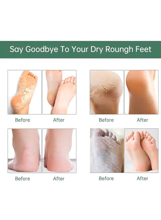 Beauty Host Tea Tree Mint Exfoliating Foot Mask, For Feet Mask Remove Dead Skin Heels Foot Peeling - pzsku/Z0719D9C7631E9862C4D0Z/45/_/1722752310/e4efa0c1-dd7c-423a-be82-52c5dbb012d2