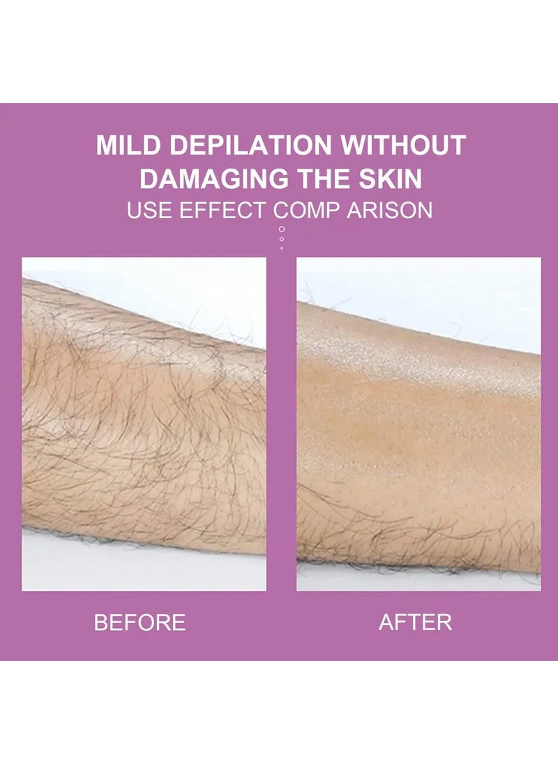 Acousticworld Epilator Crystal Epilation Device  - Image 2