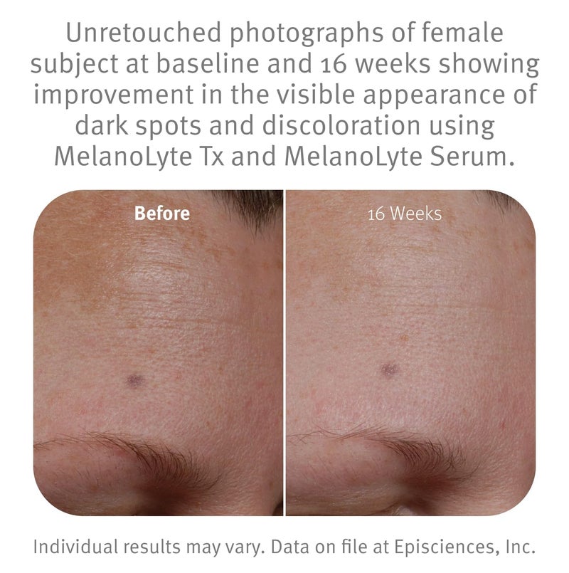 Epionce MelanoLyte Serum - Botanical-Based Night Serum for Uneven Skin Tone, For All Skin Types, Contains Turmeric, Dermatologist Skincare - Image 4