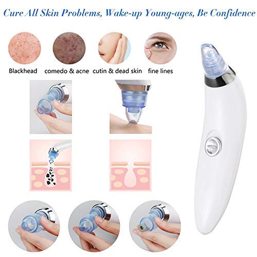 JENICO WORLD 4-in-1 Electric Derma Blackhead Remover Tool for Clearer Skin | Vacuum Suction Machine for Whitehead | Facial Cleanser Device for Face | Acne Pimple Pore Cleaner Tools for Nose - Image 2