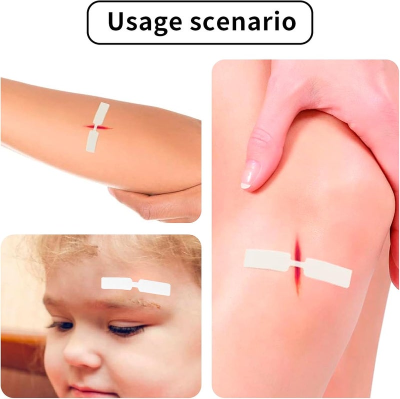AndicAge 240PCS Butterfly Closure Strips Adhesive Wound Stitch Bandages with NonStick Pad for Skin Wounds - Image 4