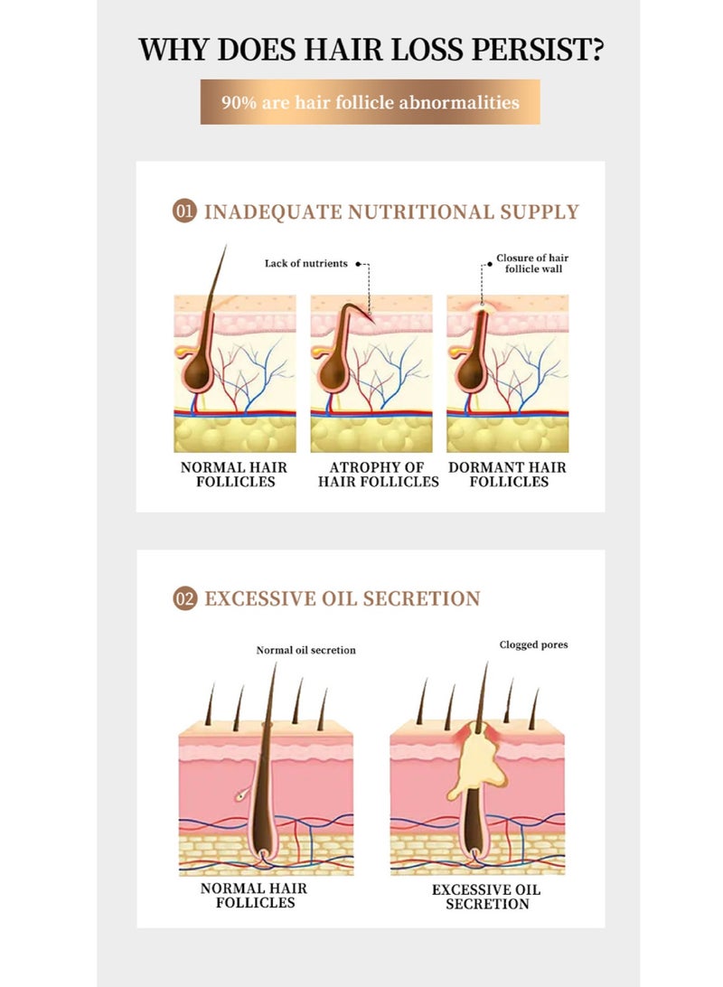 YURHERSU لوشن الشعر من يورهيرسو - مغذيات جذور الشعر 30 مل - Image 3