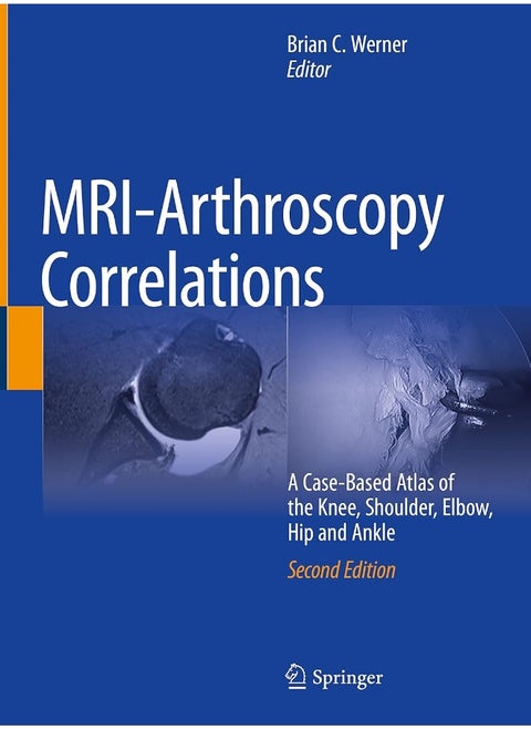 MRI-Arthroscopy Correlations: A Case-Based Atlas of the Knee, Shoulder, Elbow, H
