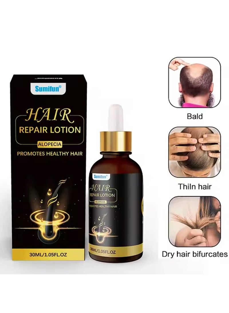 Sumifun Hair Repair Lotion, Hair Oil, Hair Loss Treatment, Moisturizing Anti Loss Hair Growth Essence, Promote Healthy Hair, Strengthen Hair Growth 30ml - Image 1