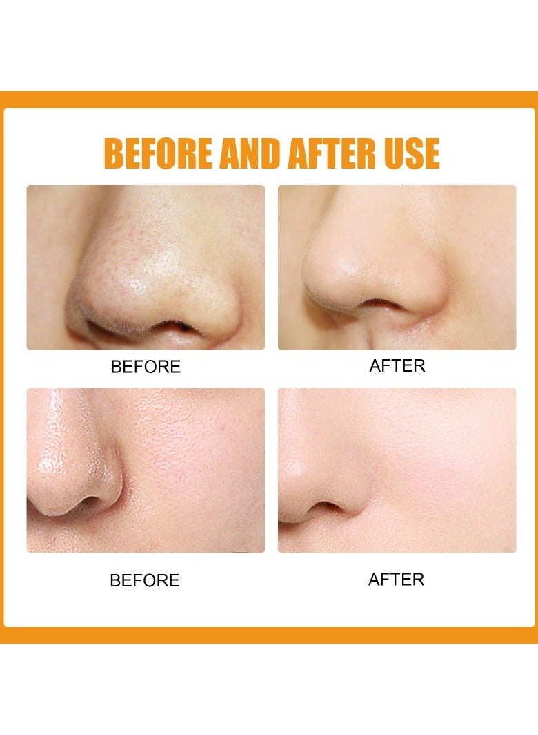 EELHOE Hydrocolloid nose patche,Remove nose blackheads and pimples, clean and shrink pores with nose patches(10 PCS) - Image 3