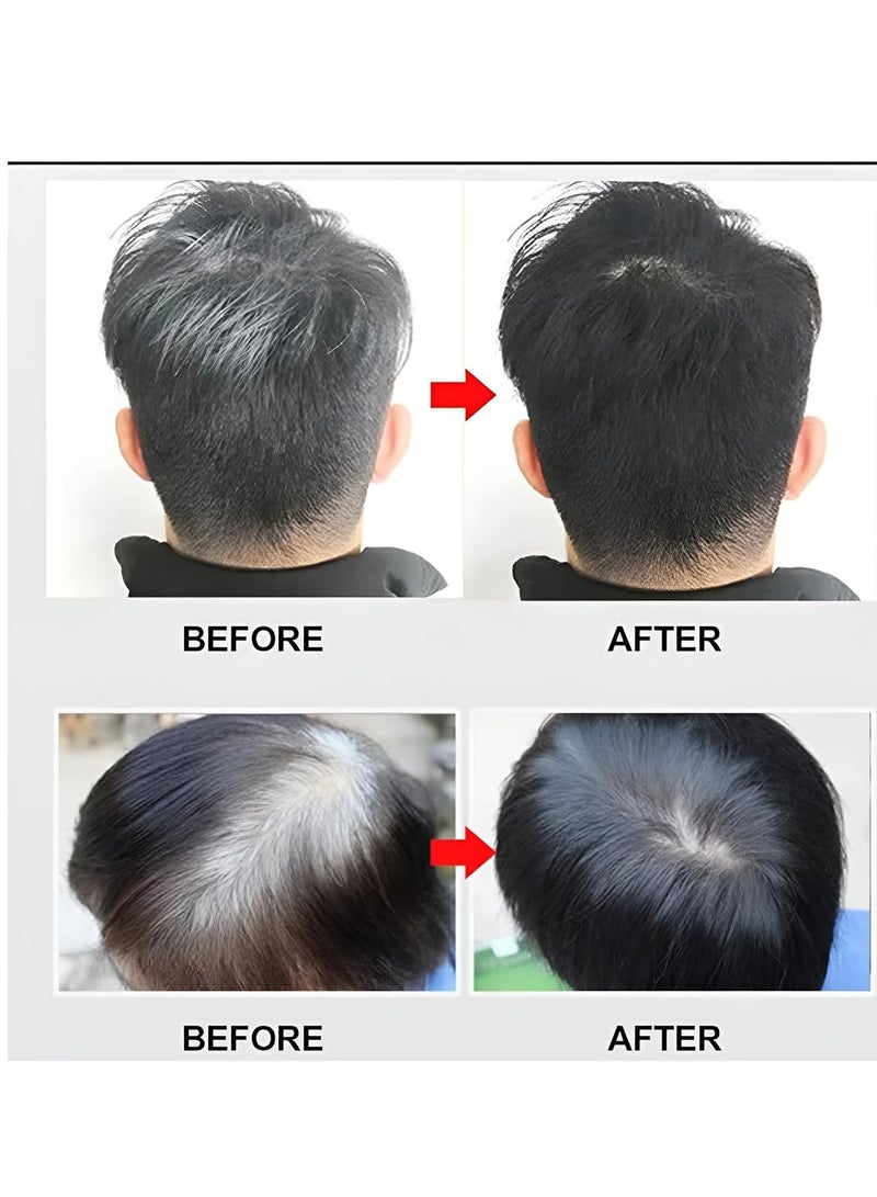 Apple Ammonia-Free Black Hair & Beard Dye Cream with Apple Fruit Extract – 500ml + 500ml - Image 4