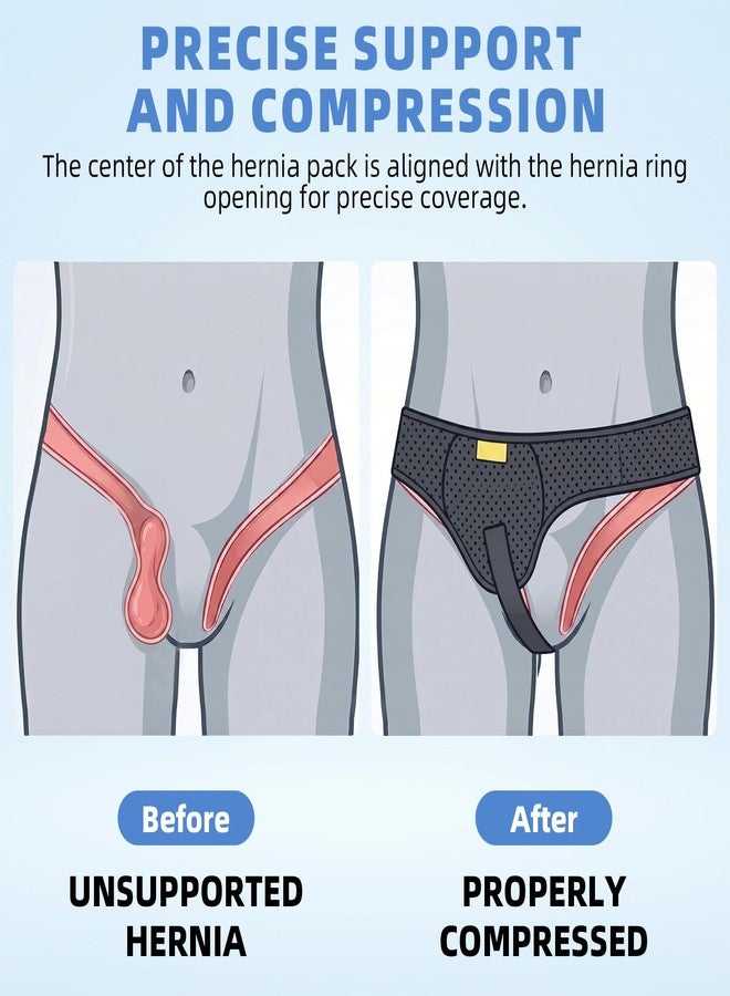 TENB Inguinal Hernia Belt for Men & Women | Adjustable Hernia Support Truss for Left or Right Side | Effective Support Before and After Surgery | Discreet & Breathable Under Clothing | Black, M - Image 3