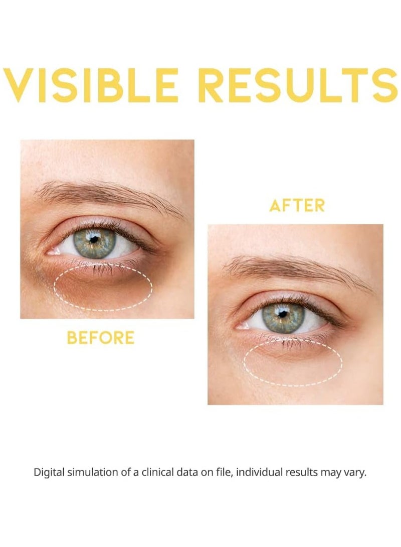 OOTD Beauty OOTD Eye Serum with Vitamin C, Niacinamide, Ceramide Korean Dark Circle Under Eye Treatment for Men and Women, Sensitive Face and Skin Care by Oxygen of the Day 30g - Image 5