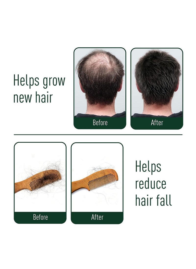 NEEM AYU - NEEM AYU Ayurvedic Anti Hair Fall Kit | Hair Oil 100ml, Shampoo 200ml & Capsules 60N | Helps to reduce hair fall by 90% within 28 days & increases hair volume| For all hair types - Image 1