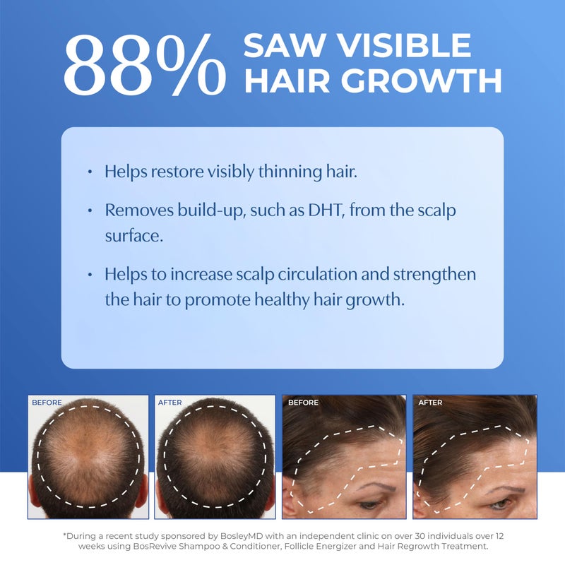 BOSLEYMD BosRevive Nourishing Shampoo for Noticeably Thinning, Non Color-Treated Hair â€“ Helps Restore Thinning Hair & Remove DHT, Product & Pollution Build-Up, Boosts Scalp Circulation, Sulfate-Free 33.8 Fl Oz - Image 2