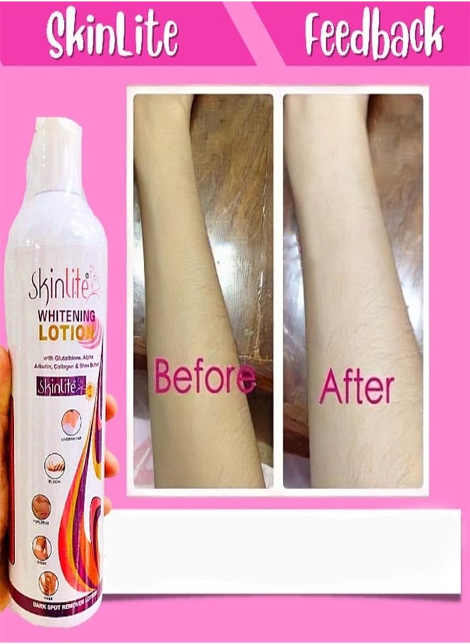 SKINLITE Ultimate Whitening Lotion with Glutathione, Alpha Arbutin, Collagen, and Shea Butter, Dark Spot Removal for Anti-Aging, Lifting and Firming, Intense Moisturization, and Sun Protection, 300g  - Image 2