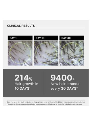 Advanced Hair Growth Serum - view 4