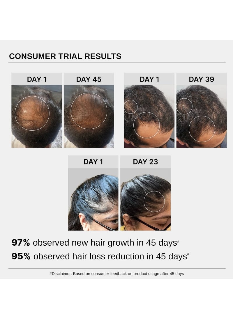BARE ANATOMY Bare Anatomy Advanced Hair Growth Serum | 3% Redensyl + 4% Anagain + 3% Baicapil + 1% Capilia Longa, Rosemary, Biotin & Rice Extract | Hair growth & Hair fall control serum for Women & Men | 30mL  - Image 5