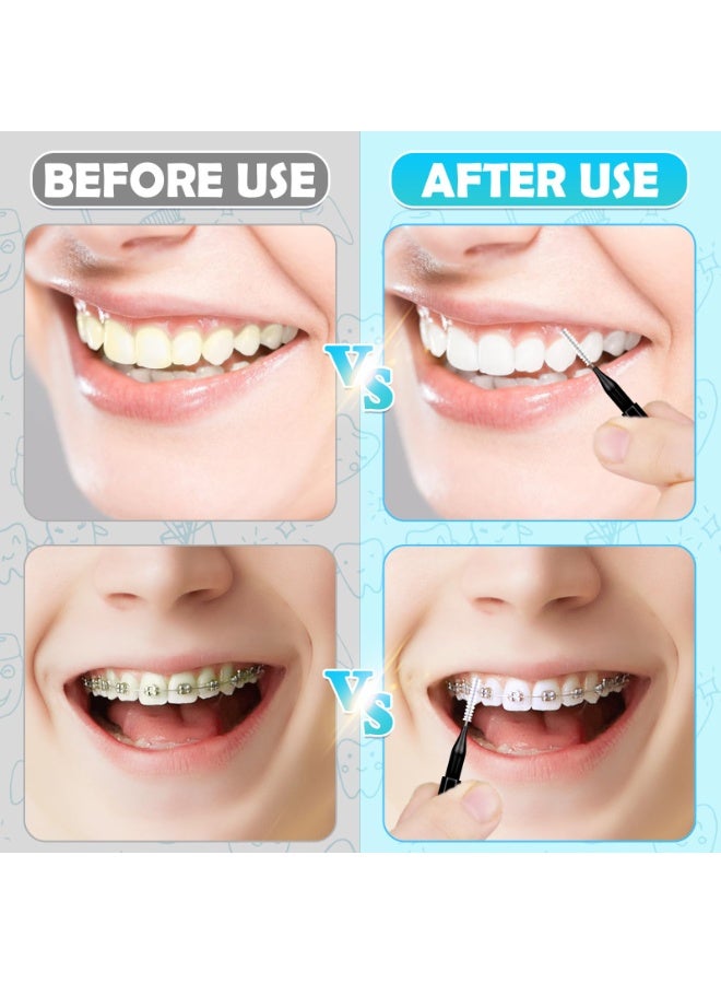 شابية 120 قطعة من فرش الأسنان، وفرشاة تقويم الأسنان، ومنظف فرشاة الأسنان، وخيط تنظيف الأسنان، وأعواد تنظيف الأسنان، ومجموعة أدوات تنظيف الأسنان، ورأس فرشاة أسنان حلزونية للعناية الفعالة بالفم (أسود) - Image 3