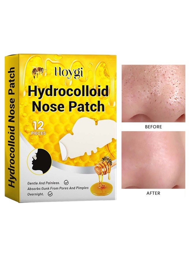 Hoygi Hydrocolloid Nose Patch,Cleansing Pore Strip for Nose Pores, Pimples, Zits and Oil - Overnight Pore Strips to Absorb Acne Nose Gunk 12Pieces  - Image 1