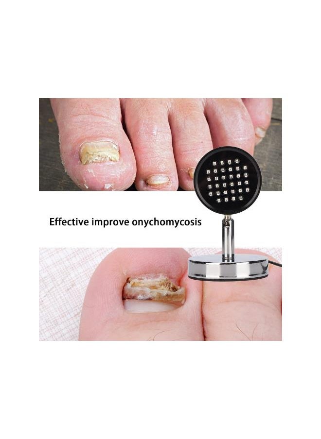 silvercnc - Nail Fungus Laser, Highly Effective Nail Fungus Treatment, Foot Care Toe Whitening Safe, Fast and Painless Treatment, Onychomycosis Removal Device - Image 1