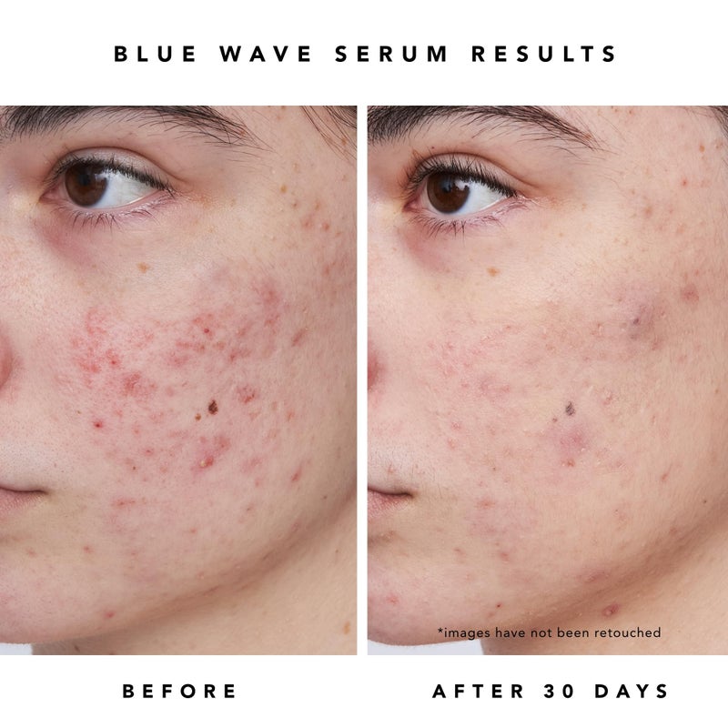 HERBIVORE Blue Besties Duo â€“ 2-Step Treatment for Acne-Prone Skin, Aquarius Cleanser (50 mL) & Blue Wave Serum (10 mL), Plant-Based, Vegan, Cruelty-Free - Image 4